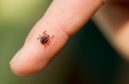 Tick-borne encephalitis