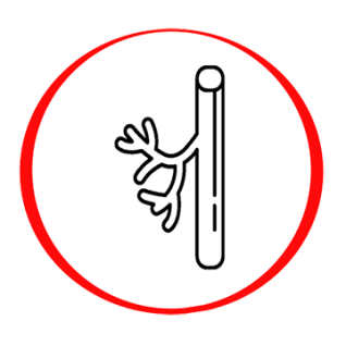 Determination of high-sensitivity troponin