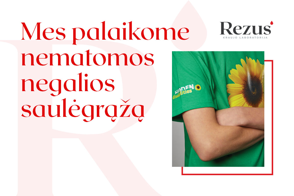 Nematomos negalios saulėgrąža paveiksliukas